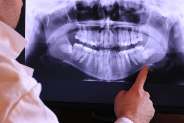 Emergency Dentist Open Today in VA