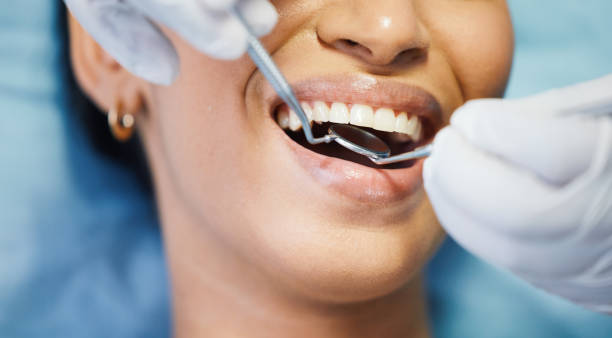 Best Dentist for Tooth Abscess  in Cana, VA